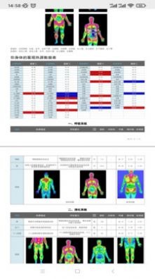 红外热成像健康管理平台