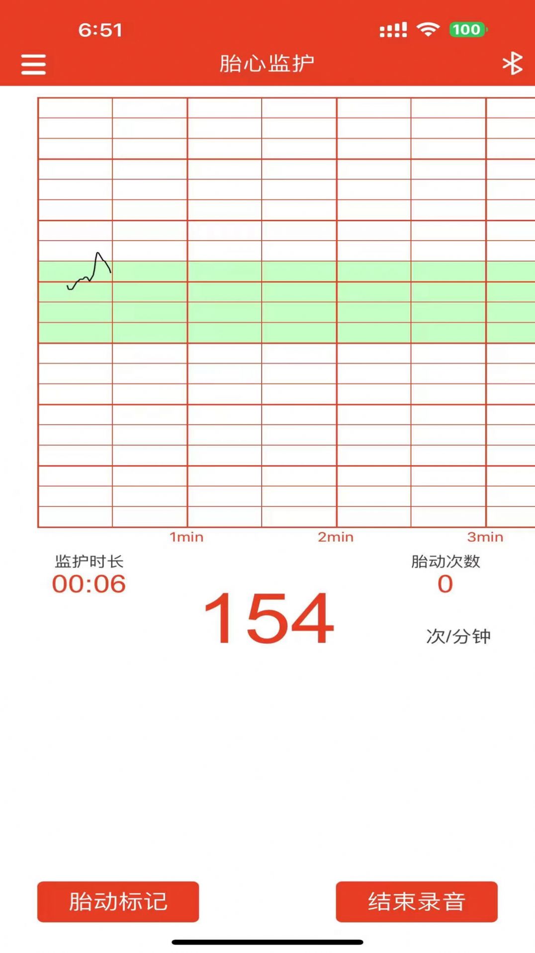 左点胎心仪软件